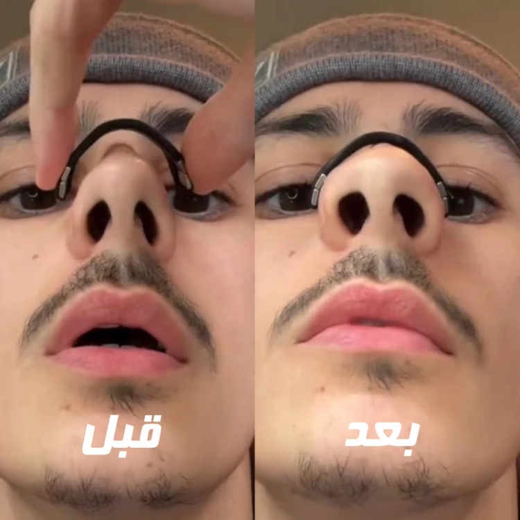 گجت جلوگیری از خروپف